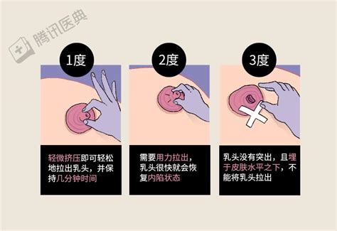 胸部长毛|不懂就问：乳头长毛毛正常吗？